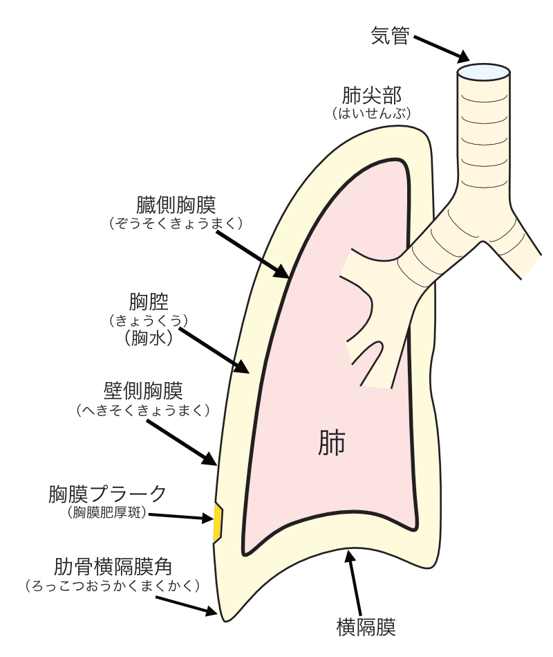 胸膜プラーク（胸膜肥厚斑）　の出来やすい部位